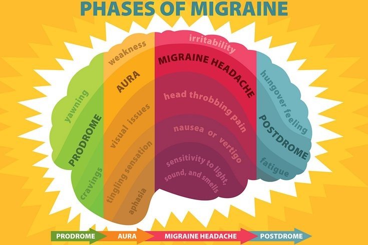 Migraine headache treatment