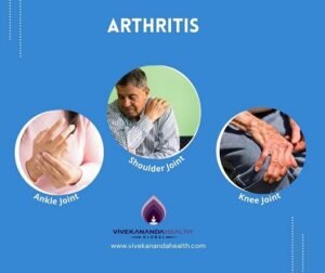 Ayurvedic treatment for Arthritis pain relief