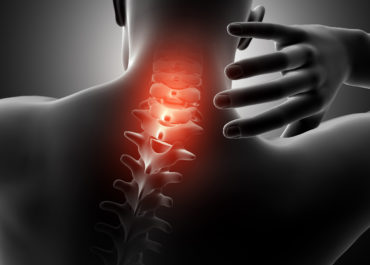 3D render of a male figure with neck highlighted in pain