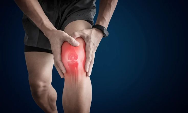 Osteoarthritis of the Knee