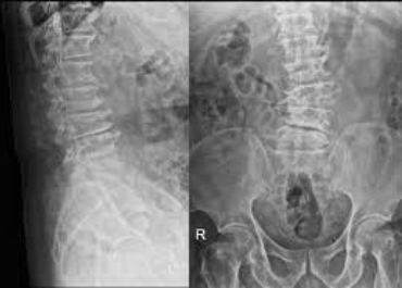 hdisc