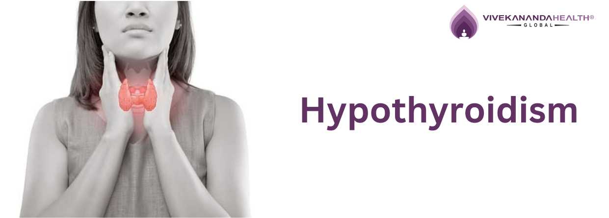 Case Study on Hypothyroidism - Vivekananda Health Global