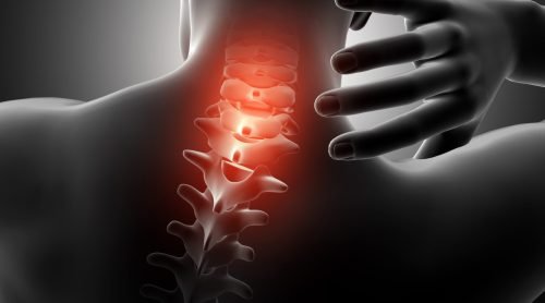3D render of a male figure with neck highlighted in pain