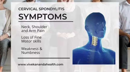 cervical-spondylitis-symtoms